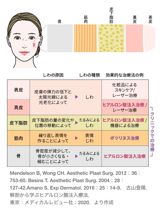 しわの原因、しわの種類に対する効果的な治療の例